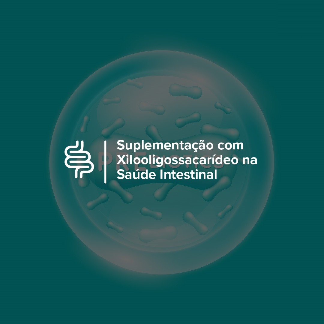 XOS